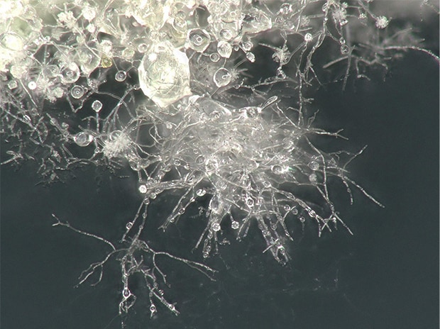 Muffa, 200x,<br>osservazione con illuminazione anulare