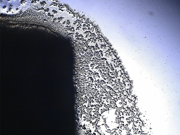 Batteri, 200x, osservazione con illuminazione polarizzata trasmessa