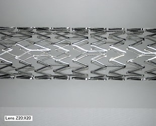 Imaging ad angolo libero di uno stent (20x)