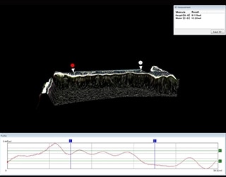 Misurazione 3D della forma e del profilo di stent bioassorbibili