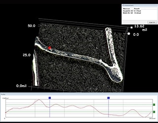 Misurazione 3D della forma e del profilo di stent bioassorbibili